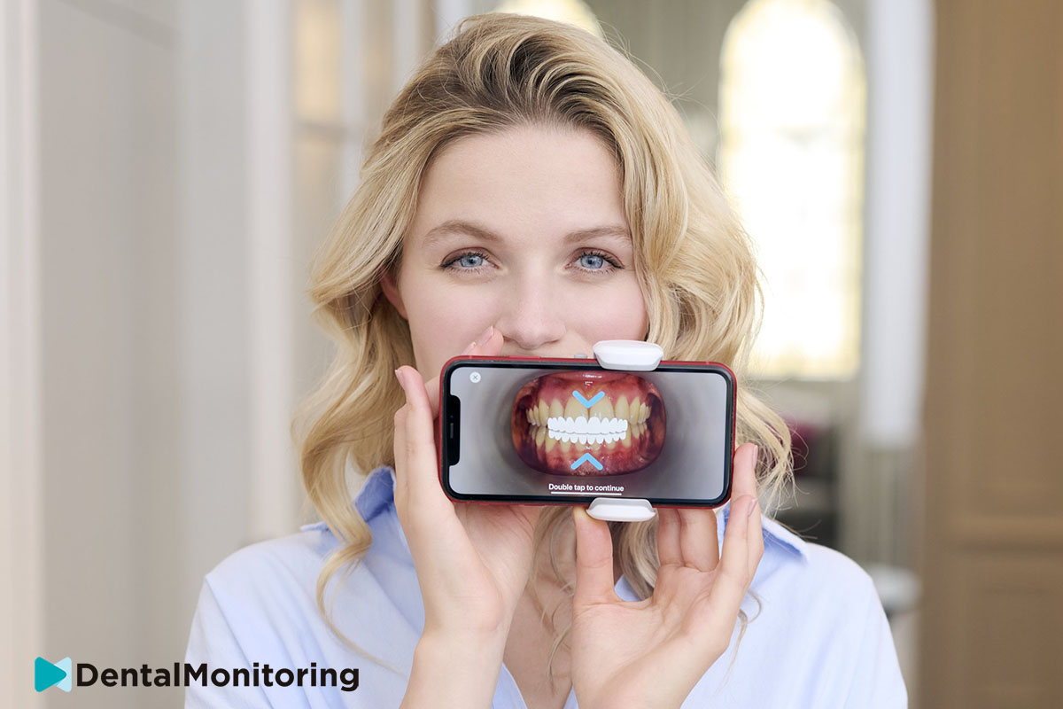 smarte technik scan box dental monitoring